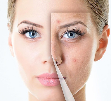 Gaziosmanpaşa Leke Bakımı